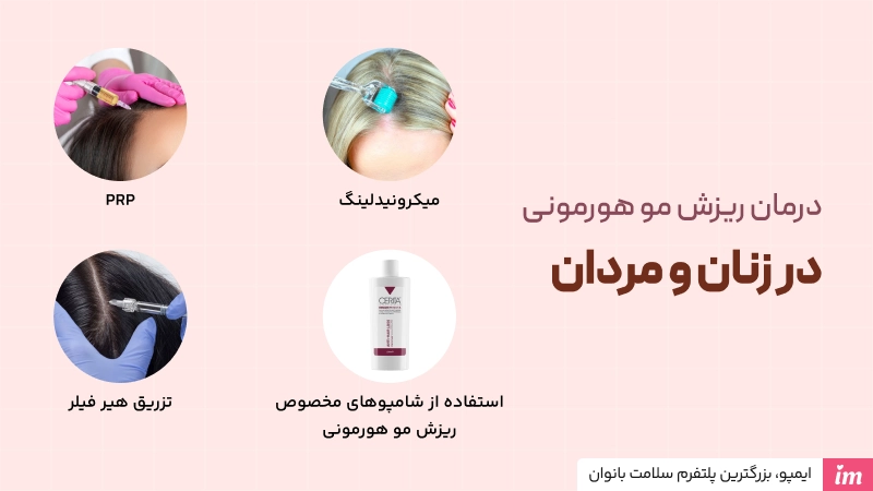 درمان ریزش مو هورمونی در زنان و مردان