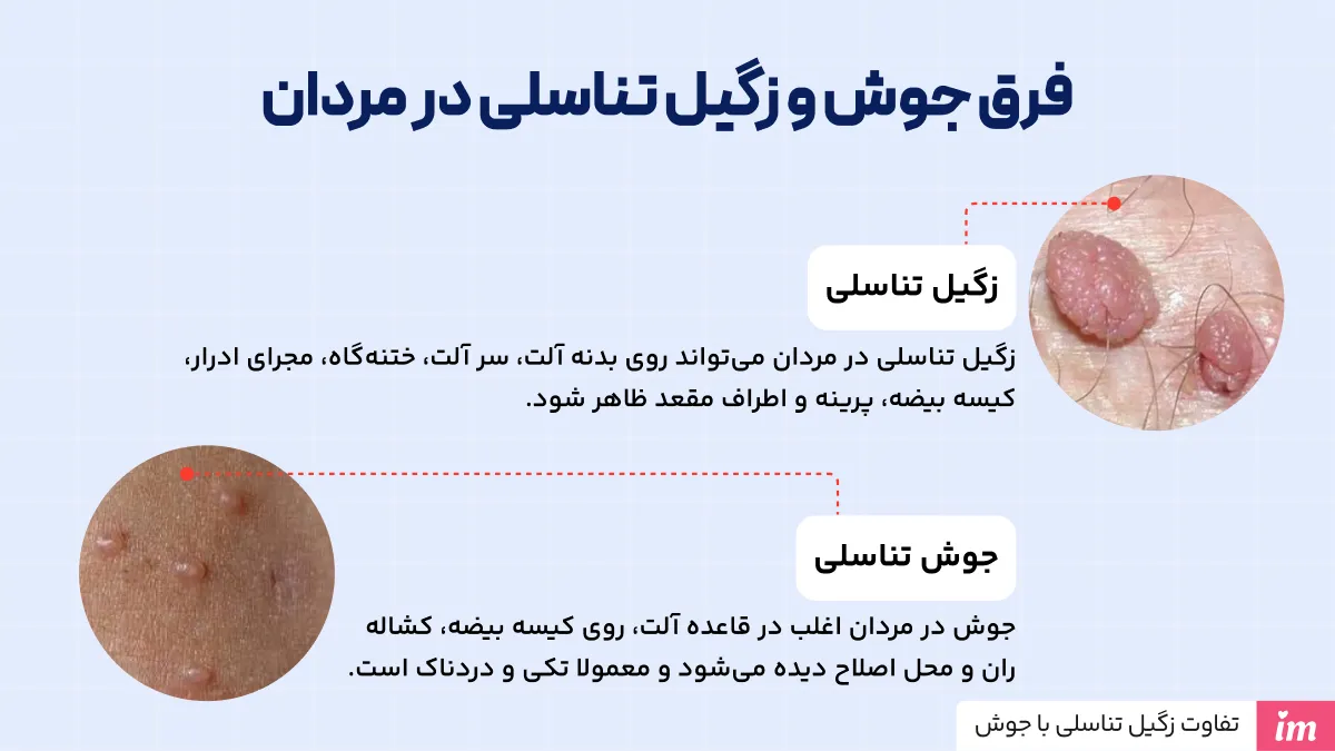 از کجا بفهمیم زگیل تناسلی داریم یا جوش در مردان