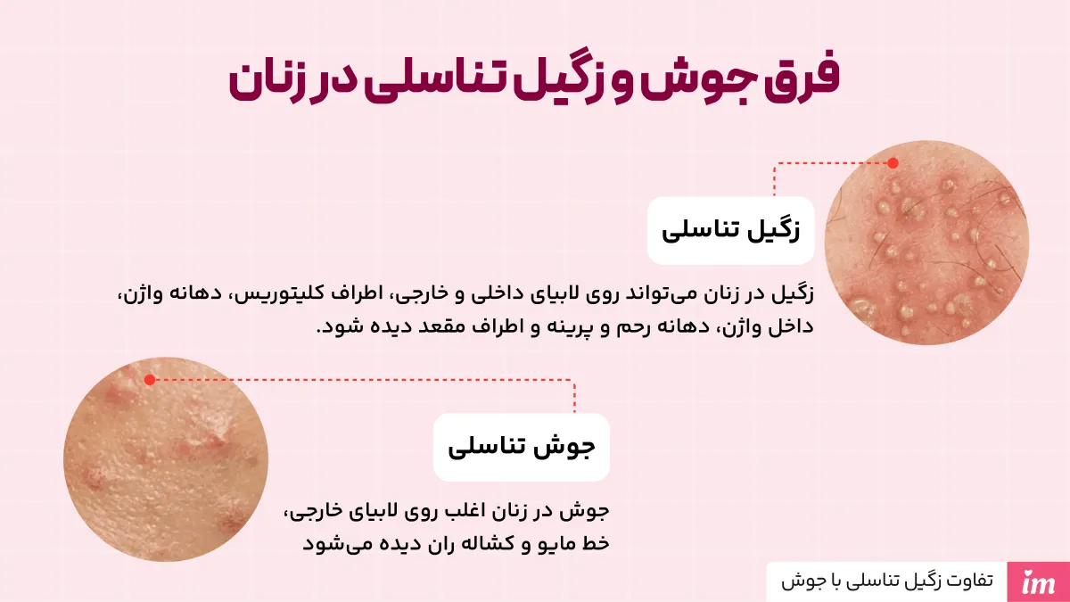 از کجا بفهمیم زگیل تناسلی داریم یا جوش در زنان